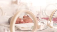 Kisah Bayi Prematur Pertama yang Dirawat di Inkubator, Berbobot Cuma 1,3 Kg