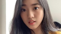 Kepala botak Nona Berlian dulu saat ini sudah semakin indah dengan rambut indah. Foto: Instagram @nonaberlian14