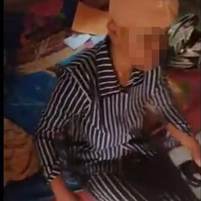 Suami Siksa Istri di Indramayu
