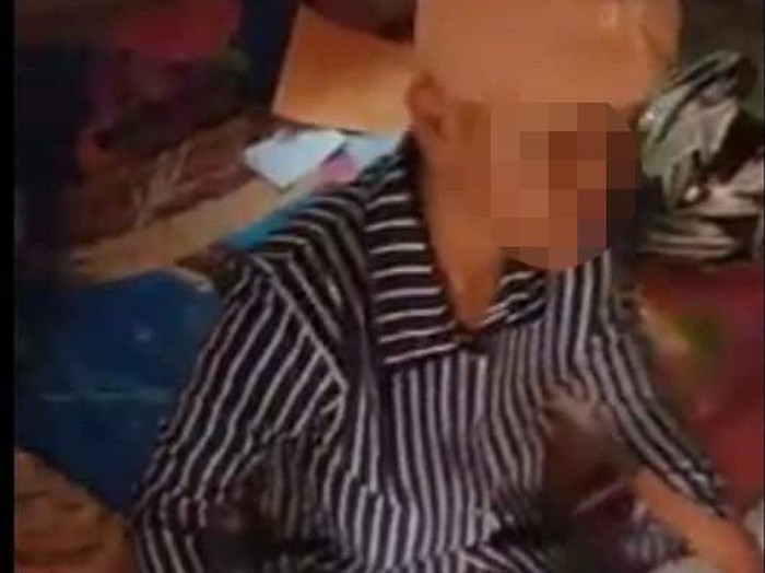 Suami Siksa Istri di Indramayu