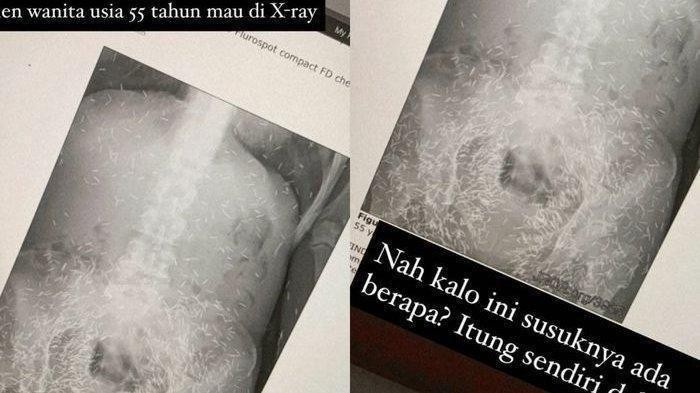 Ratusan susuk terdeteksi