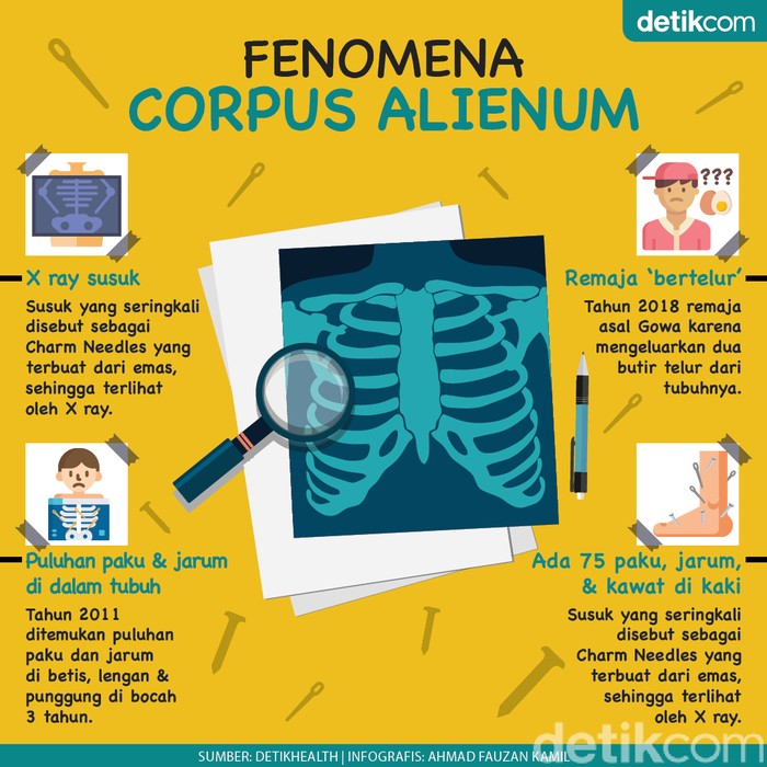 Bagaimana Dokter Menjelaskan Santet dan Susuk?