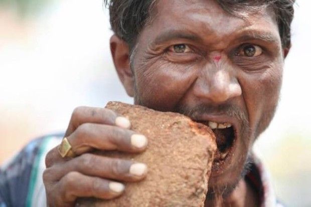 Hobi Makan Rambut hingga Kaca, 5 Gangguan Makan Teraneh di Dunia