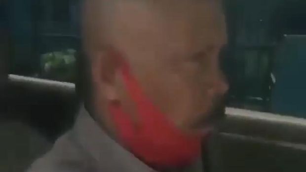 Viral Satpol PP Halagi-Tabrak Ambulans di Bogor, Ini Kata Polisi