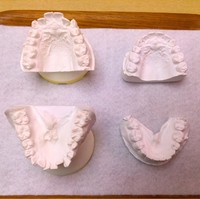 Selain wajah, wanita itu juga memperbaiki gigi hingga wajahnya tampak lebih tirus. Di akun Twitter, ia pun membagikan foto bagaimana struktur giginya berubah. Foto: Twitter @Qpr_7