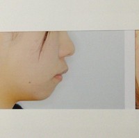 Aku sangat membenci wajahku bahkan aku tidak ingin orang melihat wajahku jadi aku tidak mau berjalan ke luar atau naik kereta. Itu lah mengapa orangtuaku menjemputku dari sekolah dengan mobil, ungkap Mikishi kepada majalah SPA. Foto: Twitter @Qpr_7