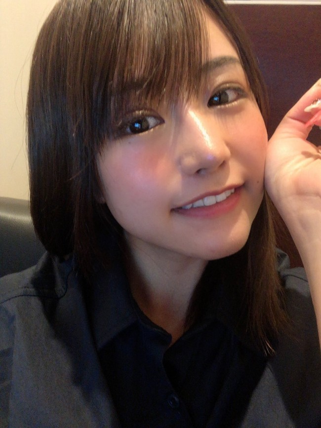 Setelahnya, Mikishi mulai menjalani prosedur lain seperti implan dagu, operasi hidung, operasi mata kedua. Hingga kini ia sudah melakukan empat operasi besar yang menghabiskan 4 juta yen atau sekitar Rp 564 jutaan. Selain dibantu oleh orangtua, wanita 25 tahun tersebut mengaku meminjam uang yang terpaksa dilakukannya dari pada mengalami depresi. Foto: Twitter @Qpr_7