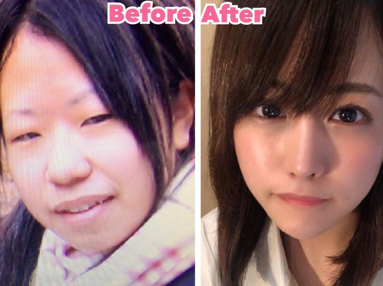 Potret Wanita Jepang yang Transformasi Oplasnya Bikin Netizen Kaget
