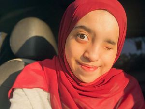 Kisah Viral Hijabers Medan Alami Skoliosis: Mata dan Wajah Aku Tak Simetris