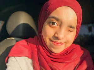 Kisah Viral Hijabers Medan Alami Skoliosis: Mata dan Wajah Aku Tak Simetris