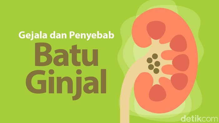 Perlu Tahu! Gejala dan Penyebab Penyakit Batu Ginjal