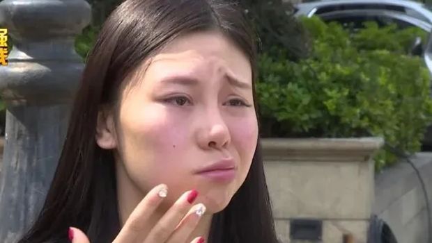 Wanita di China lumpuh sebelah di wajah setelah suntik filler.