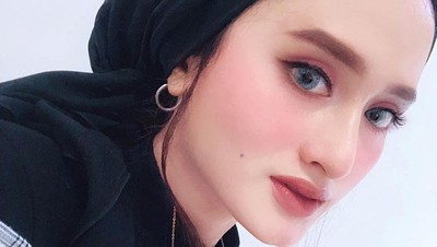 Foto Selebgram Aceh Cantik yang Kembali Ditaksir Mantan Setelah Turun 30 Kg