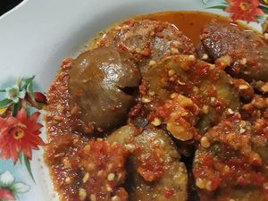 Dokter Urologi Beberkan Gejala Sakit Ginjal gegara Kebanyakan Makan Jengkol