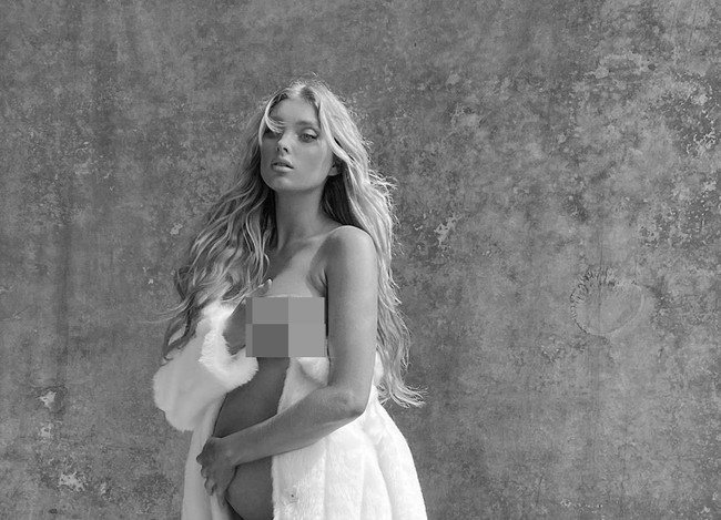 Dikabarkan People, Elsa Hosk baru berbagi kabar bahagia tentang kehamilannya ketika usia kandungan sudah memasuki 21 minggu. Telah menyembunyikan malaikat di perutku ini untuk beberapa waktu, kata perempuan asal Swedia ini kepada 6 juta pengikutnya di Instagram. (Foto: Instagram/@hoskelsa)