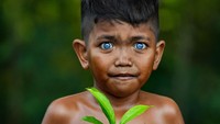 Dari beberapa sumber menyebut Sindrom Waardenburg merupakan kelainan kongenital. Artinya, kelainan hadir sejak lahir. Obatnya belum ada, namun kondisi itu bisa dikelola. saat terlalu banyak cahaya masuk ke mata, biasanya mata mereka berair. (Korchnoi Pasaribu for detikTravel)