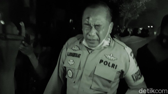 Karo Ops Polda Banten Terluka