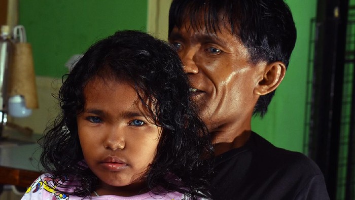 Zulbahri dan Zizy (putrinya) bermata biru.