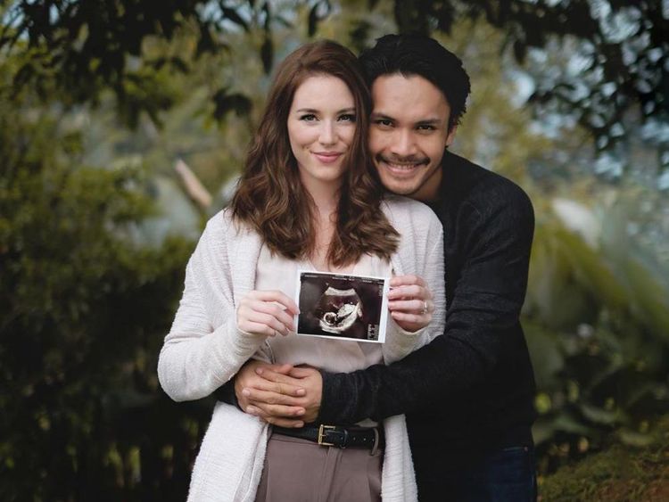 10 Potret Kemesraan Randy Pangalila & Istri Bulenya yang Hamil Anak Pertama