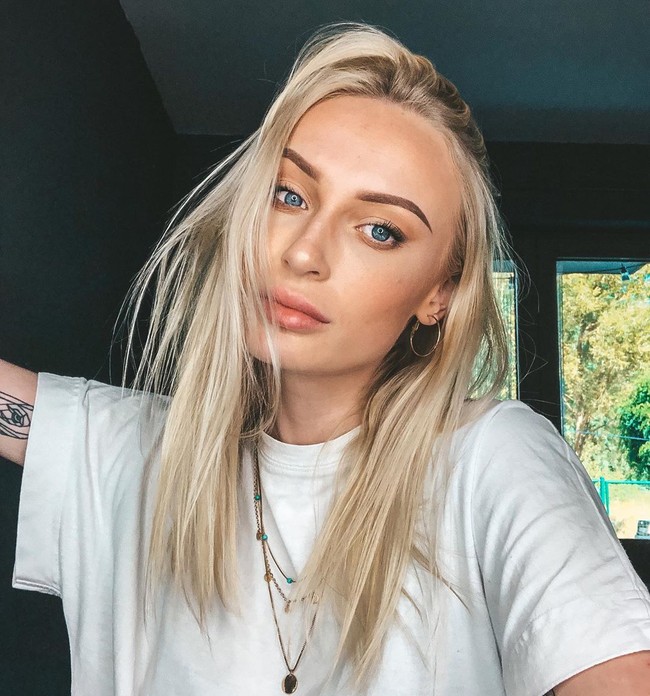 Semenjak itu mantannya semakin sering melakukan kekerasan yang akhirnya membawa Anthonia berakhir di rumah sakit. Dokter yang memeriksa lukaku sangat jelas mengatakan kamu dipukul dengan keras di dahimu. Jika pukulan sedikit lebih keras, kamu bisa saja sudah meninggal sekarang, kata Anthonia. Foto: Twitter/Instagram Anthonia Rochus