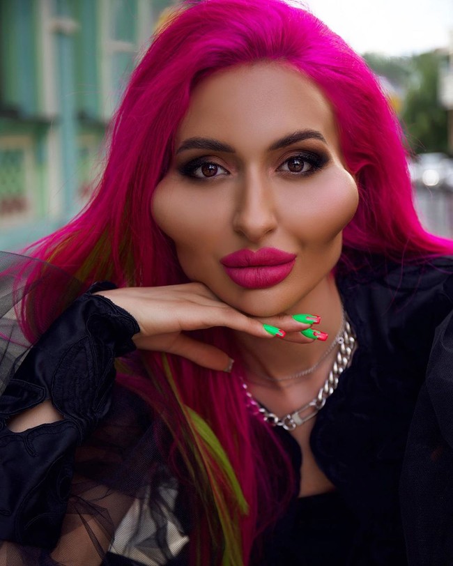 Tak hanya melakukan filler pipi, Anastasia juga melakukan prosedur kecantikan lainnya. Dia juga melakukan filler bibir. Foto: Instagram @_just__queen_