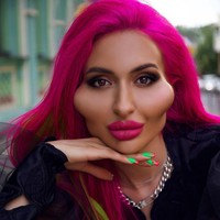 Tak hanya melakukan filler pipi, Anastasia juga melakukan prosedur kecantikan lainnya. Dia juga melakukan filler bibir. Foto: Instagram @_just__queen_