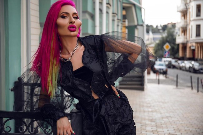 Selebgram asal Ukraina ini punya penampilan wajah yang tidak wajar. Anastasia Pokreshchuk terobsesi punya pipi terbesar di dunia.  Foto: Instagram @_just__queen_