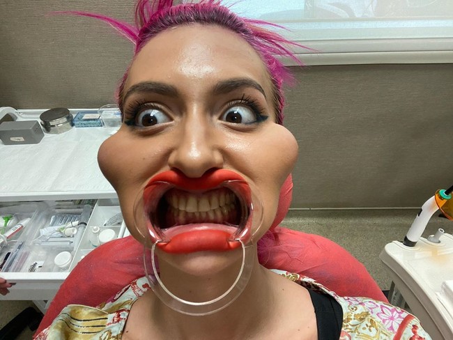 Inilah penampilan Anastasia dengan pipinya yang mancung. Meski ia sering dihujat karena penampilannya yang tidak biasa, selebgram 30 tahun itu tidak peduli. Foto: Instagram @_just__queen_