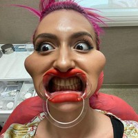 Inilah penampilan Anastasia dengan pipinya yang mancung. Meski ia sering dihujat karena penampilannya yang tidak biasa, selebgram 30 tahun itu tidak peduli. Foto: Instagram @_just__queen_