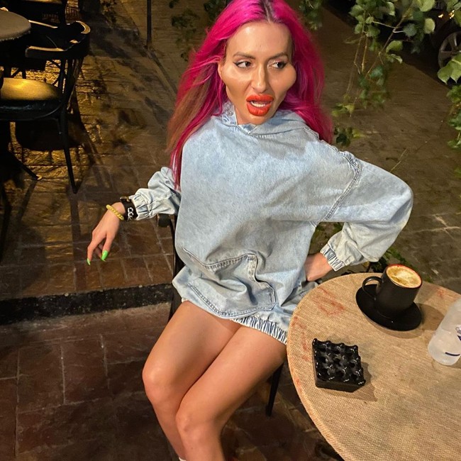 Aku suka dengan pipiku, aku ingin terus seperti ini. Aku sangat senang. Aku terus-menerus akan menginjeksi bagian wajahku ini, ungkap Anastasia, seperti dikutip The Sun.  Foto: Instagram @_just__queen_