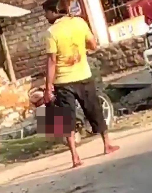 Pria India Mutilasi Kepala Istri yang Selingkuh