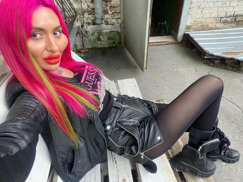 Model Instagram dengan 'Pipi Paling Besar di Dunia'.