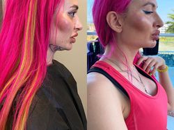 Model Instagram dengan Pipi Paling Besar di Dunia