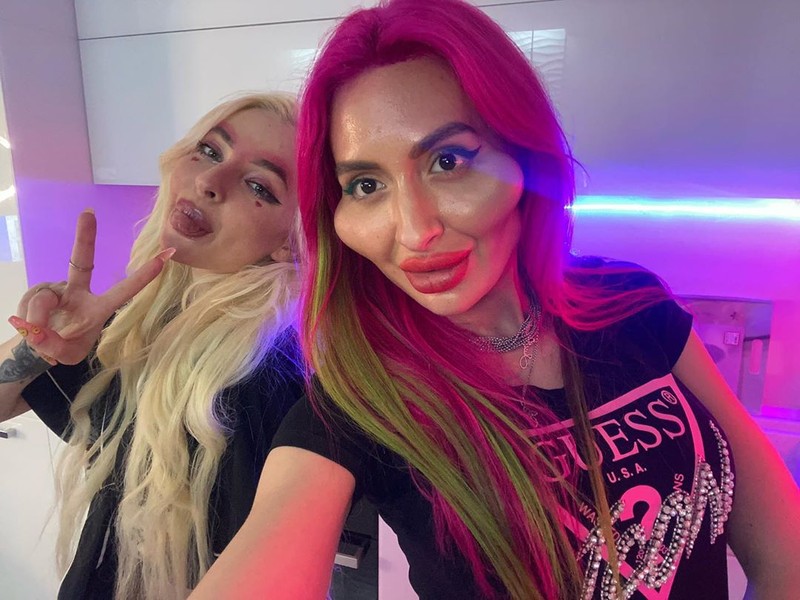 Model Instagram dengan 'Pipi Paling Besar di Dunia'.