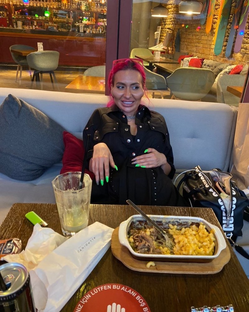 Model Instagram dengan 'Pipi Paling Besar di Dunia'.