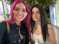 Model Instagram dengan Pipi Paling Besar di Dunia