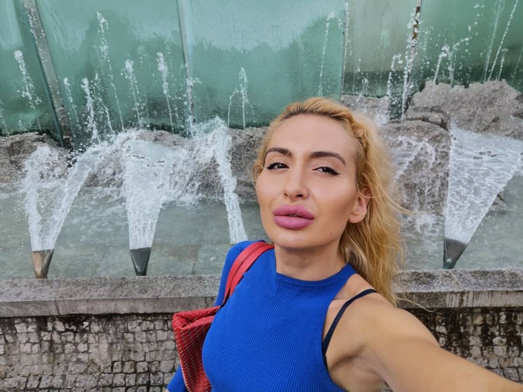 Model Instagram dengan Pipi Paling Besar di Dunia.