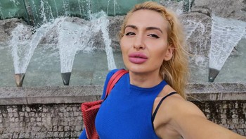 Ini adalah tampilan Anastasia sebelumnya, tampilan pipinya jauh lebih kecil dibandingkan sekarang. Foto: Instagram/@_just__queen_