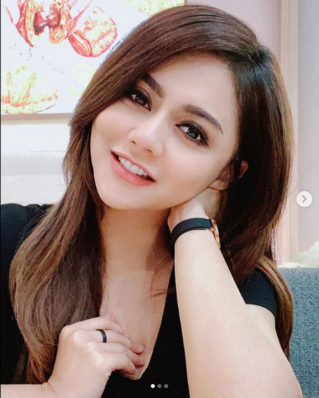 Pedangdut Jenita Janet meningkatkan kecantikan wajahnya dengan banyak perawatan. Pada unggahan klinik kecantikan Dermaster terungkap, Jenita Janet melakukan perawatan botox, filler, platinum whitening, hingga tarik benang (serupa tanam benang, namun berbeda jenis benangnya). Foto: Dok. Instagram