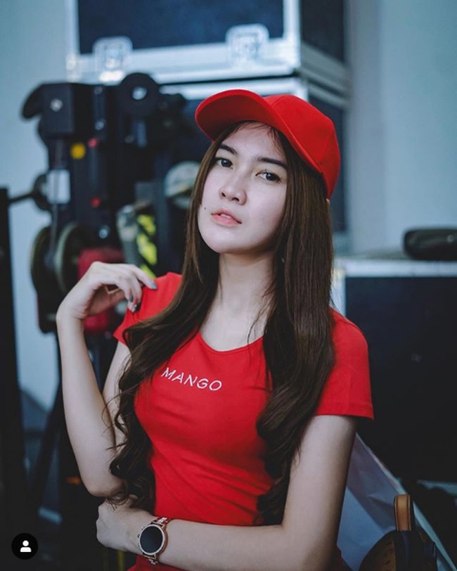 Penyanyi dangdut Nella Kharisma juga mempercantik wajahnya dengan tarik benang (serupa tanam benang, namun berbeda jenis benangnya). Setelah tanam benang, Nella memiliki wajah yang lebih proporsional dan tirus. Foto: Dok. Instagram