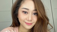 Denise Chariesta mengaku kini sudah sadar. Foto: Instagram @denisechariesta