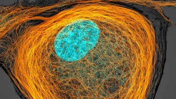 Posisi ke-7, Mikrotubulus (oranye) di dalam sel. Inti ditampilkan dalam warna sian. Karya Jason Kirk. Foto: Small World Photomicrography Nikon 2020