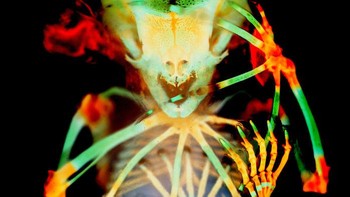 Posisi ke-20 Persiapan kerangka embrio kelelawar buah ekor pendek (Carollia perspicillata). Karya Dr. Dorit Hockman, Dr. Vanessa Chong-Morrison.Foto: Small World Photomicrography Nikon 2020