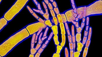 Posisi ke-11 Red Algae karya Dr. Tagide deCarvalho. Foto: Small World Photomicrography Nikon 2020