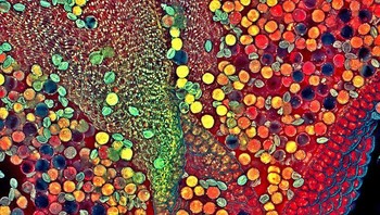 Posisi ke-6, potret hebe tanaman antera dengan serbuk sari karya Dr. Robert Markus, Zsuza Markus. Foto: Small World Photomicrography Nikon 2020