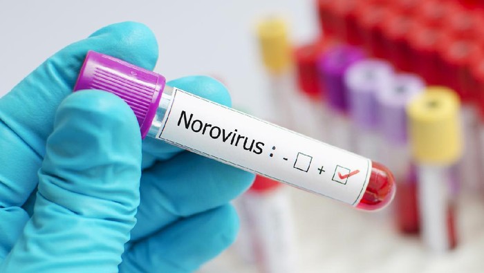 Lebih dari 1.500 Warga Inggris Terinfeksi Norovirus, Alami Demam hingga Muntah