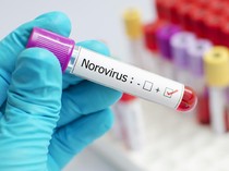 Infeksi Norovirus Mewabah di Kapal Pesiar Ambition, Prancis Isolasi Penumpang