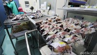 Plasma kompalisen ini mengandung zat antibodi yang melawan virus dan membantu penderita dengan gejala berat untuk melawan komplikasi organ.