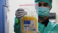 Petugas medis PMI Solo memperlihatkan contoh kantong plasma darah.