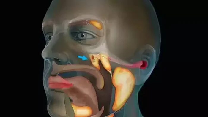 Para dokter di Belanda menemukan sesuatu di persimpangan hidung dan tenggorokan. Kemungkinan ini bakal jadi organ baru manusia.
